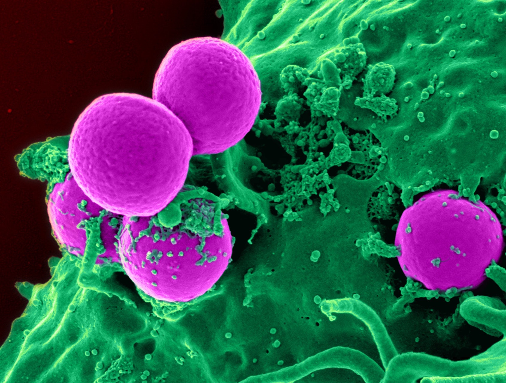 Microscopic representation of antimicrobial activity